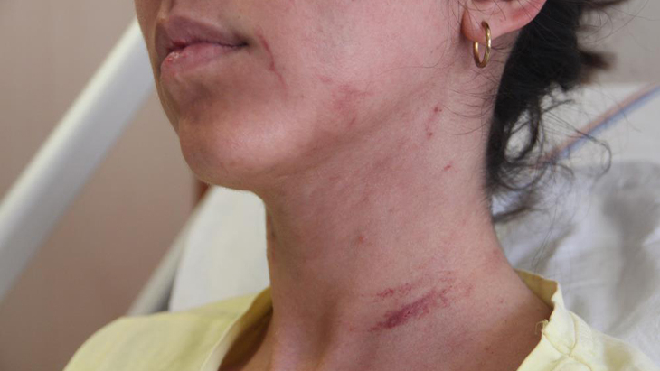 Elazığ'da kadına şiddet!